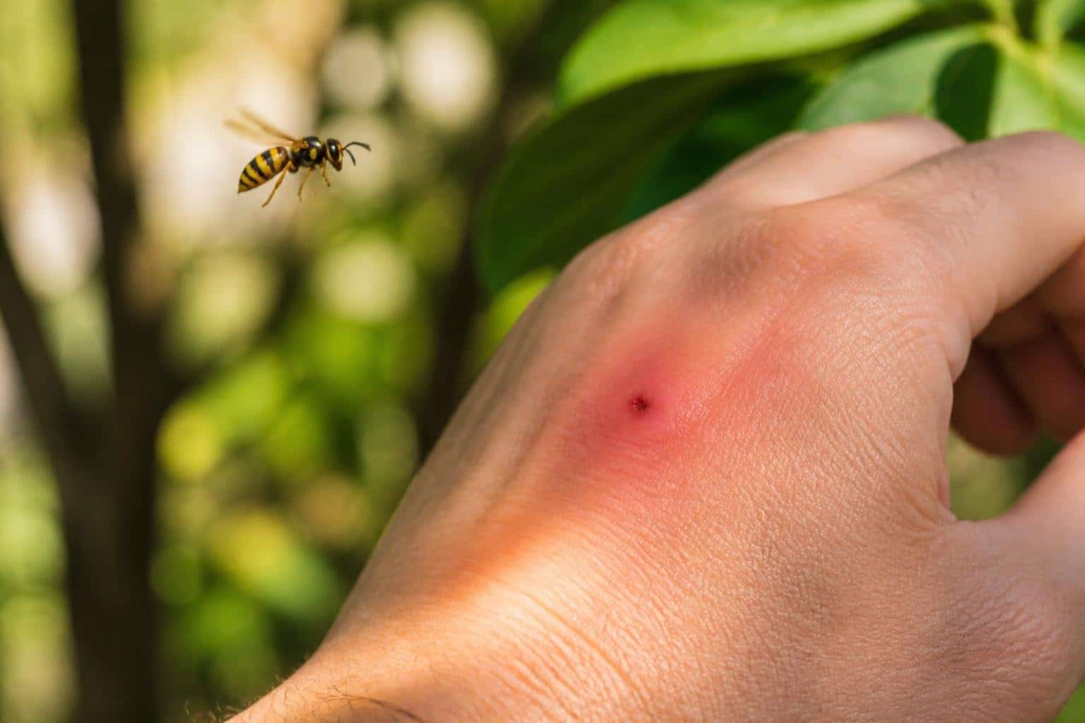 Close-up de uma mão com picada de marimbondo e um marimbondo voando próximo, com fundo desfocado de natureza.